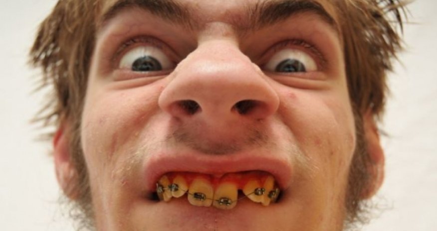 Why wannabe brides pick an ugly husband