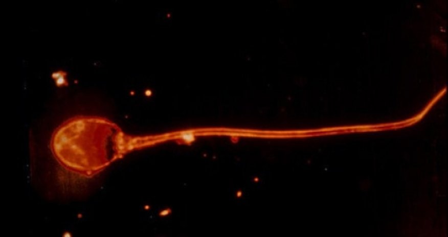 Gentlemen, your sperm is under attack – but don't panic