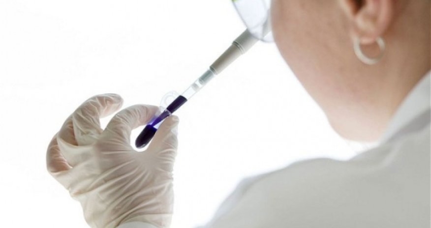 'Death test' predicts chance of healthy person dying within five years