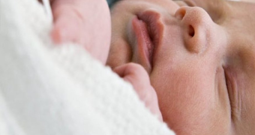 C-section birth "link to later obesity"