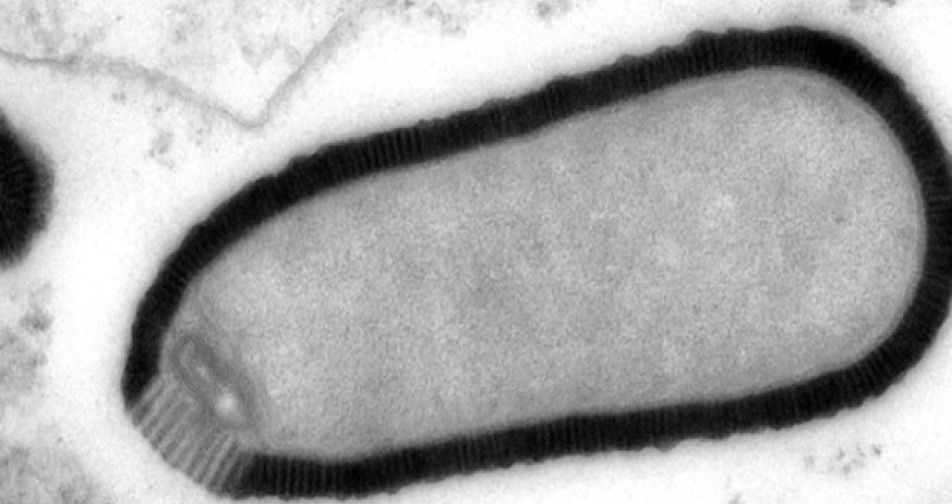 30,000-year-old giant virus 'comes back to life'