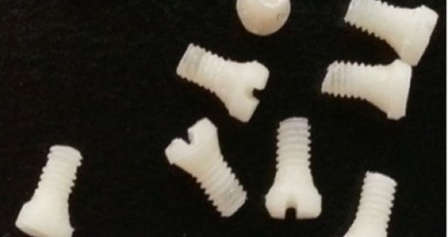 Silk screws used to repair fractures