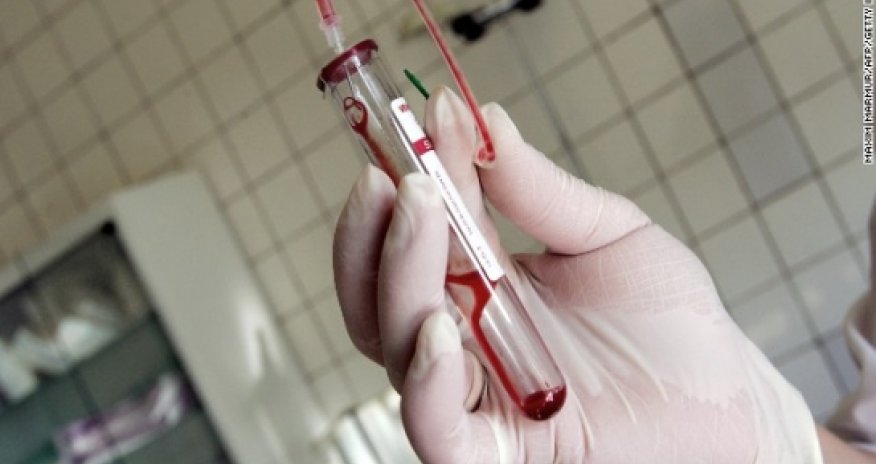 Second baby possibly 'cured' of HIV