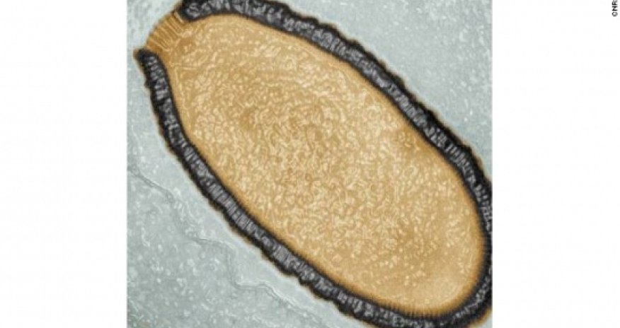 Scientists dig up giant virus more than 30,000 years old