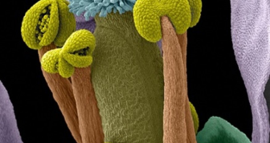 Wellcome image awards 2014: life in extreme close-up