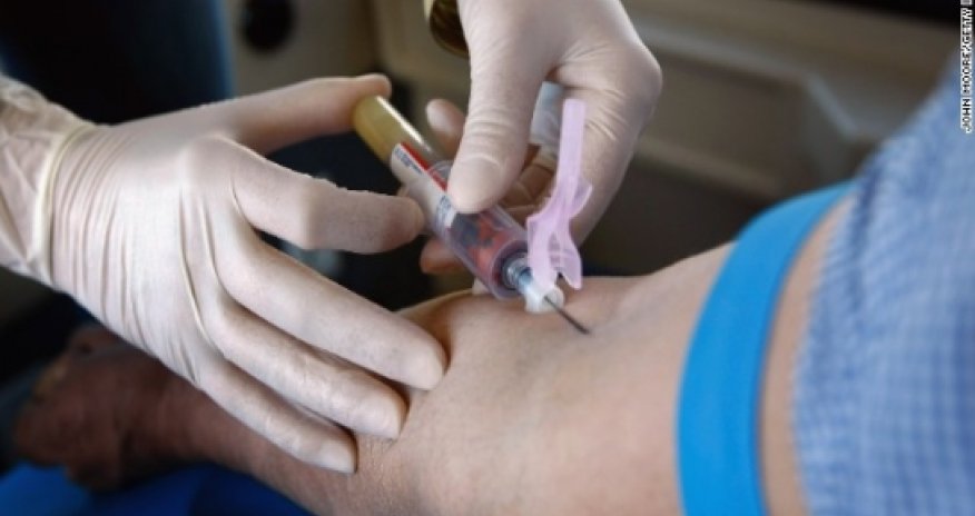 Test may some day predict 5-year risk of death