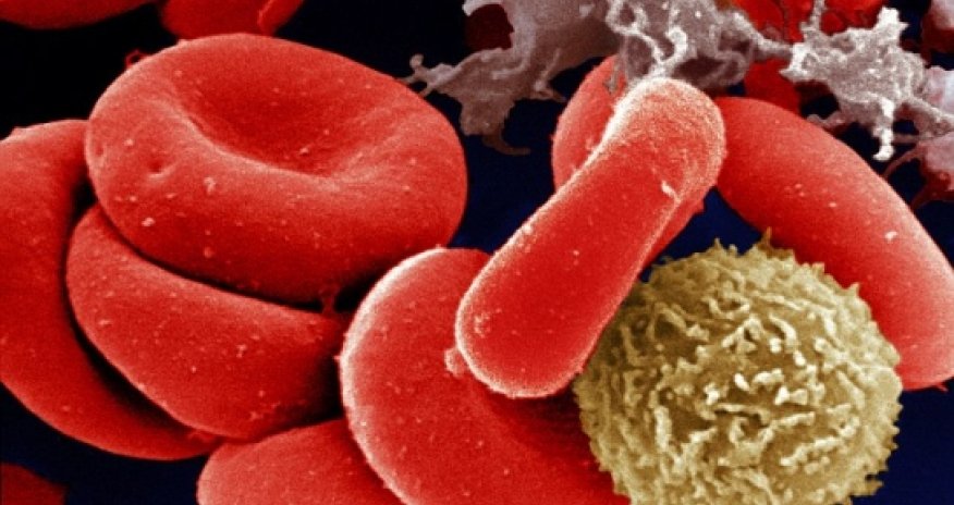 Thousands of healthy people wrongly told they have cancer