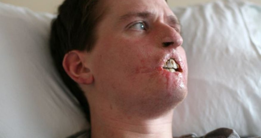 Man loses three limbs and half his face - PHOTO