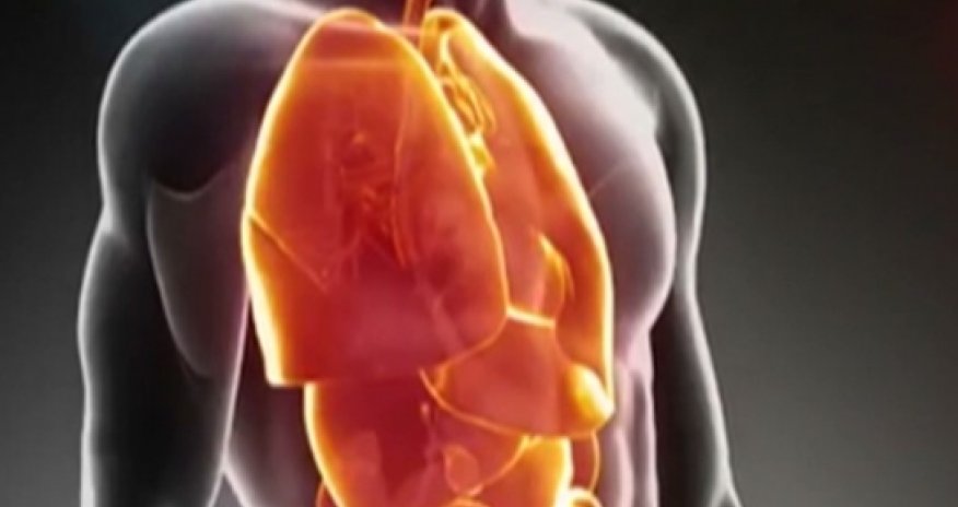 The next frontier in 3-D printing: Human organs - VIDEO