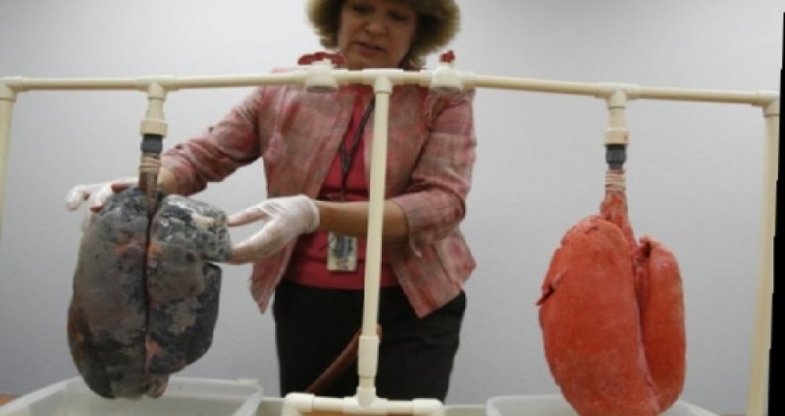 Smokers vs Normal Lungs - VIDEO