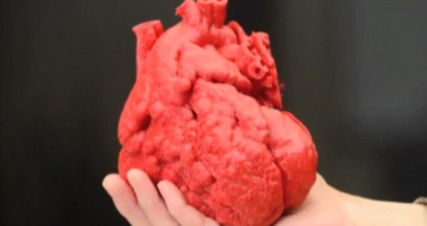The 3D printed HEART