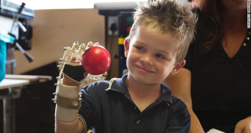 3-D printing the human body - PHOTO