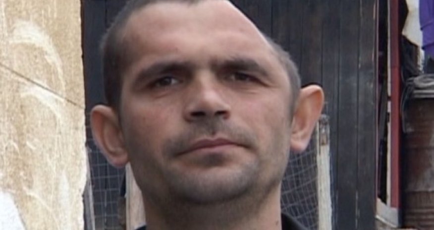 Shocking images of man who lost half of his HEAD - PHOTO+VIDEO