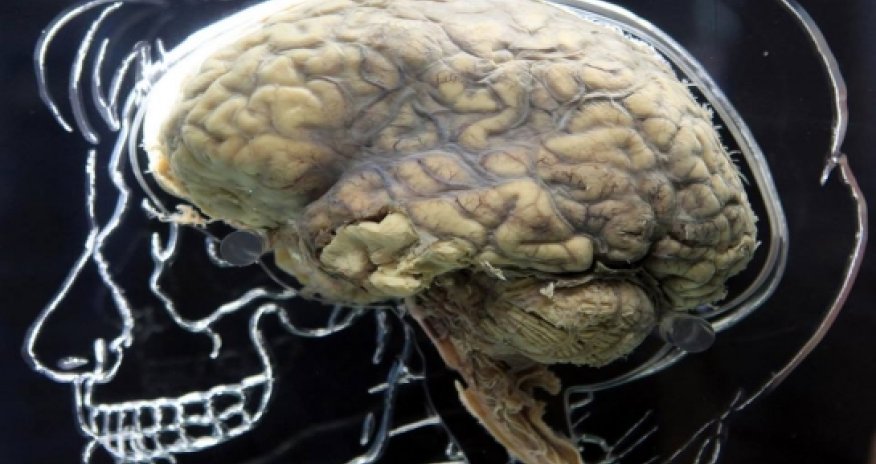 Scientists developed an “off-switch” for the brain