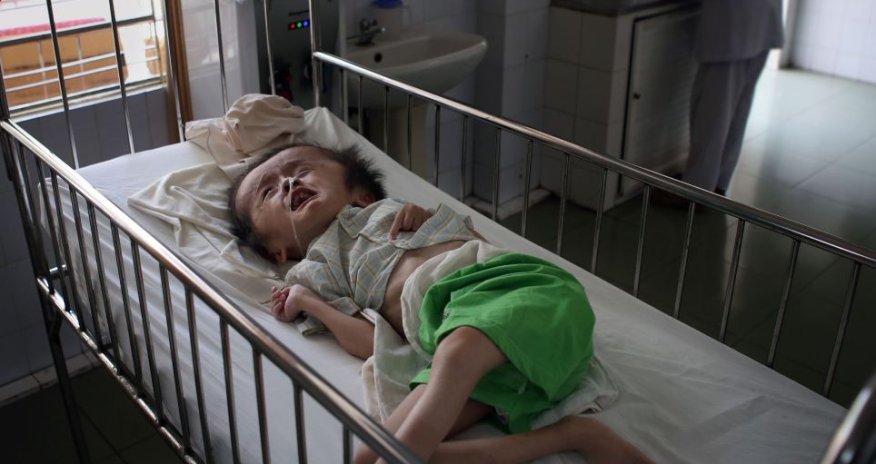 Heartbreaking pictures show even now babies in Vietnam - PHOTO
