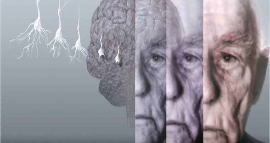 Dementia Facebook app to raise awareness of the illness