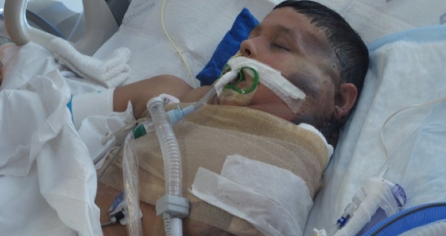 Mexican boy is recovering after watermelon-sized tumor is removed - VIDEO