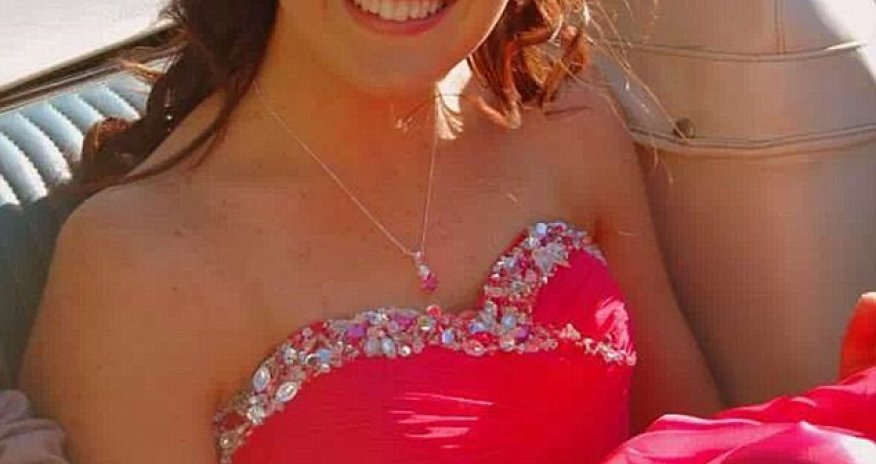 Teenager whose skin 'burnt from the inside out'