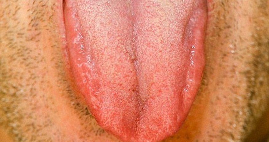 What does your tongue say about your health?