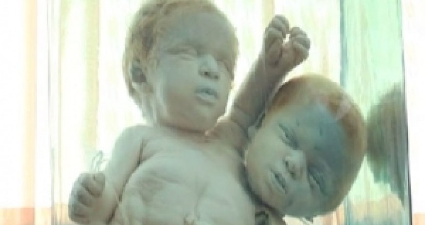 Bakıda 700 insan başı, təpəgöz körpələr...  - VİDEO