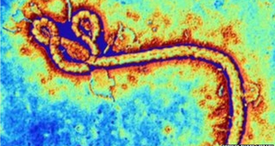 Ebola vaccine trial 'interrupted' due to joint pains