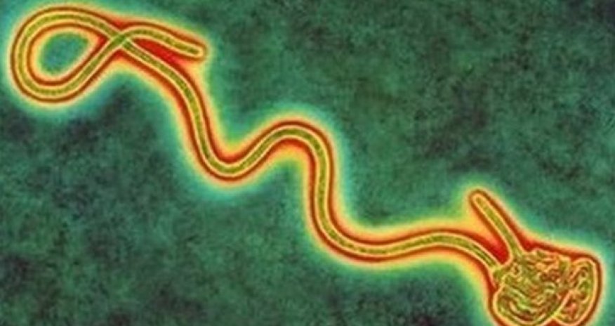 Ebola serum supply reaches Liberia