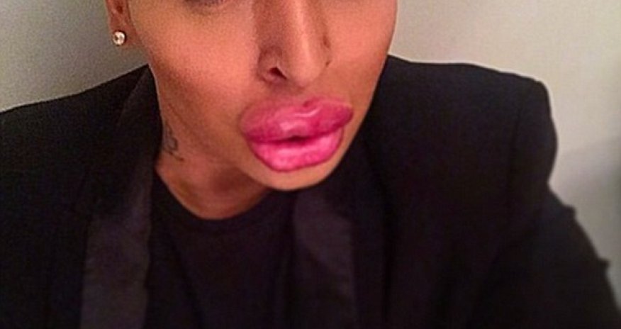 Jordan James Parke spent $150,000 on over 50 cosmetic procedures