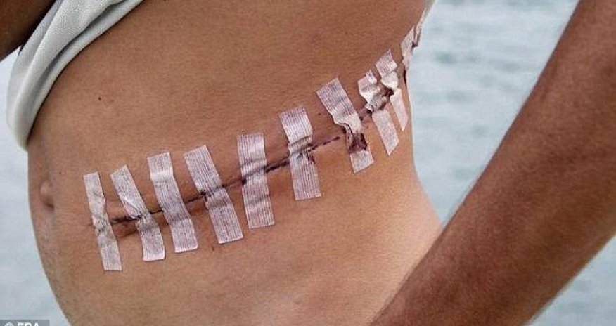 How ISIS is selling human organs