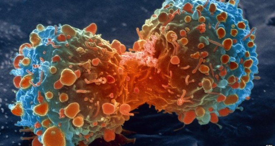 Most cancer types 'just bad luck'