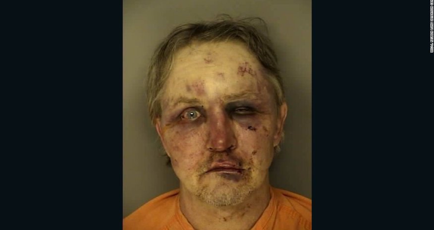 Man arrested in rough shape after alleged sexual assault