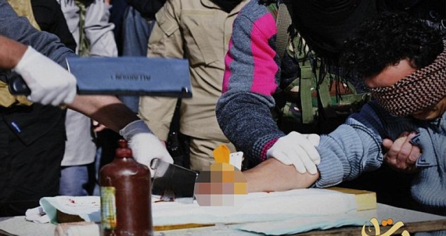 Thief has his hand cut off in front of a baying crowd