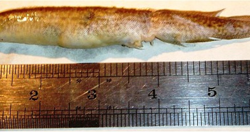 Teenager has 6-inch live EEL gets stuck in his throat for five hours