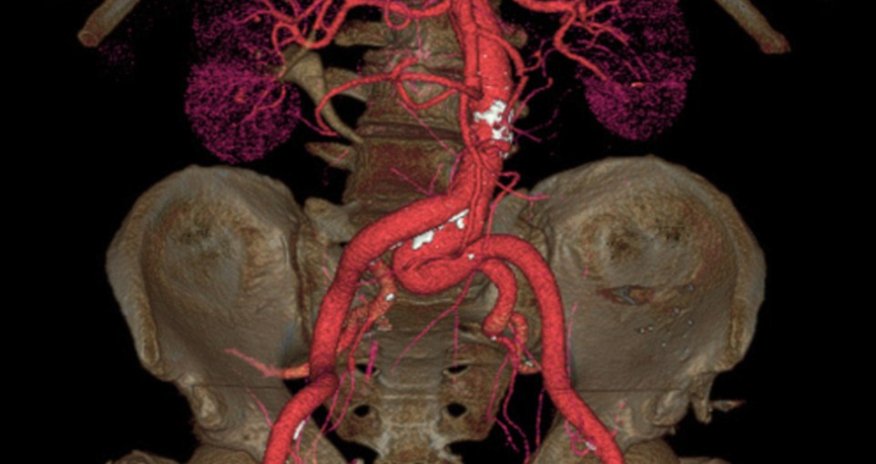 Brains, veins and bones as you've never seen them