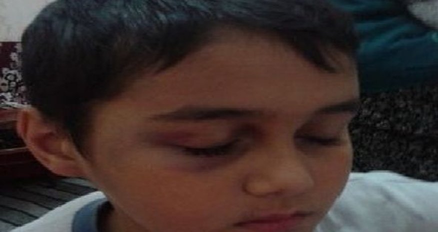 В Сумгаите учительница избила ученика?