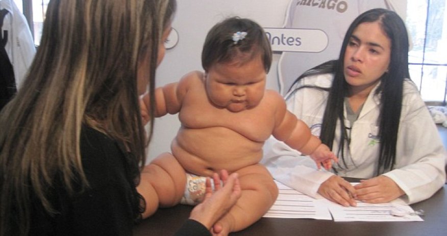 The 10-month-old who weighs as much as a five-year-old