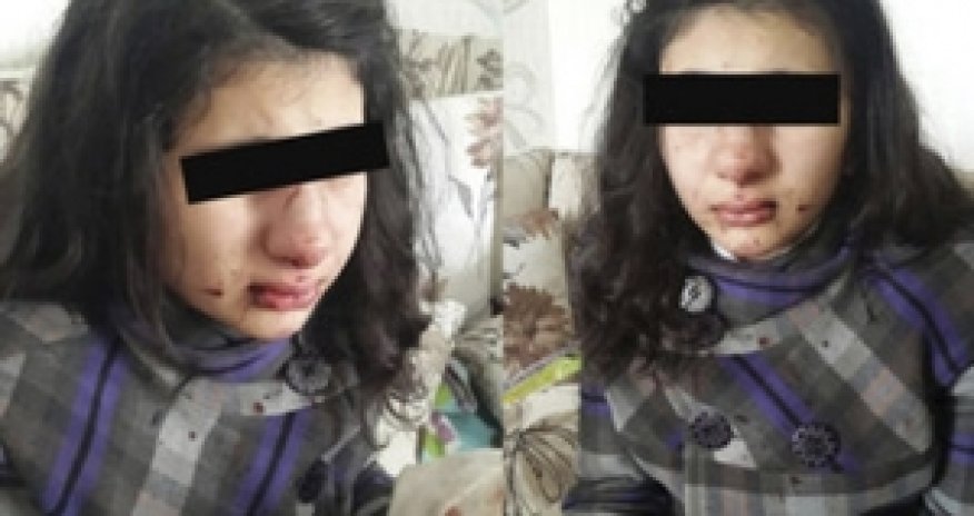Bakıda manyak məktəbli qızı döydü - FOTO
