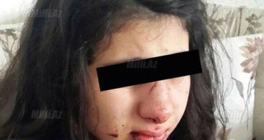 Подробности избиения школьницы в Баку