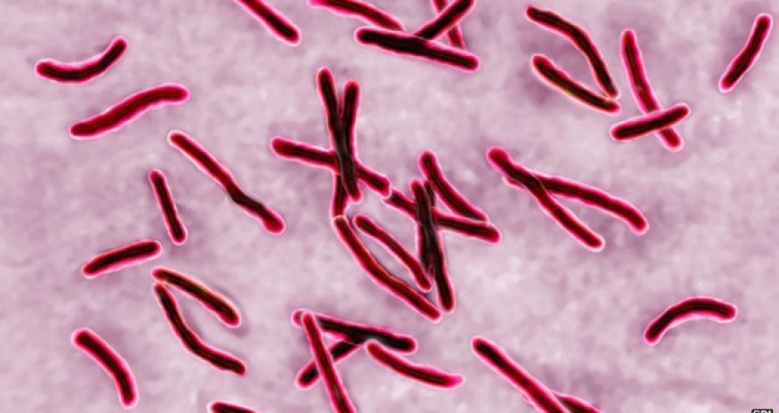 Call to boost antibiotics funding to tackle 'looming crisis'