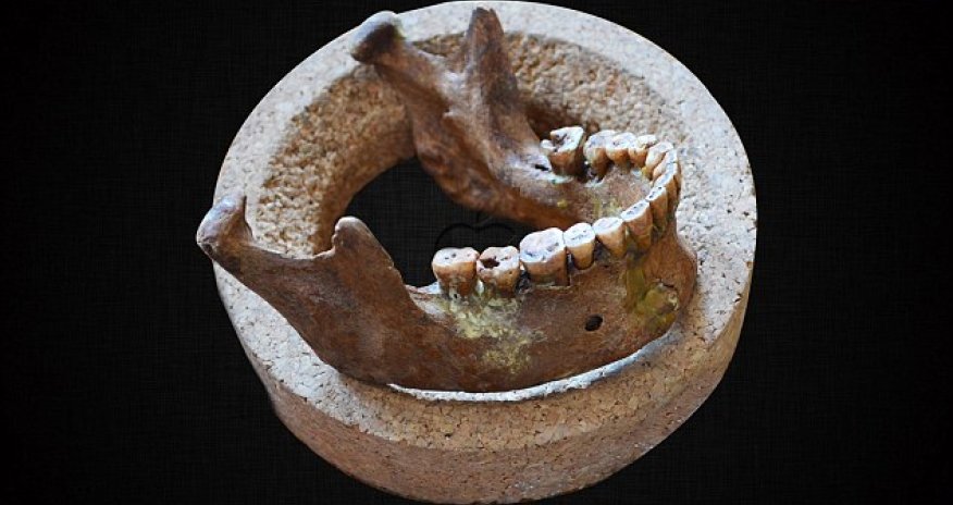 How the dawn of farming ruined our TEETH