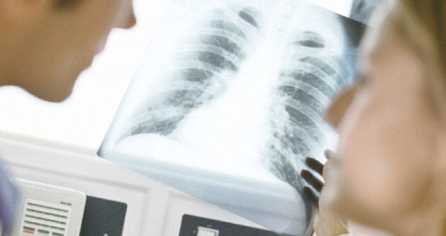 E-cigarettes are 'NOT a safe alternative to smoking'