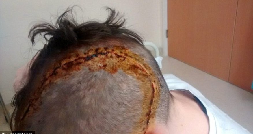 Horrific injuries of 16-year-old boy