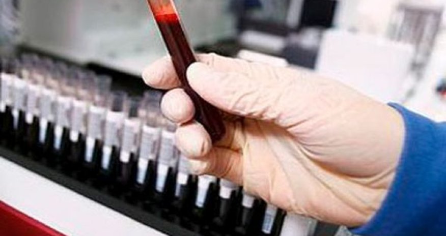 Azərbaycanda talassemiya xəstəliyinin ən çox yayıldığı rayonlar
