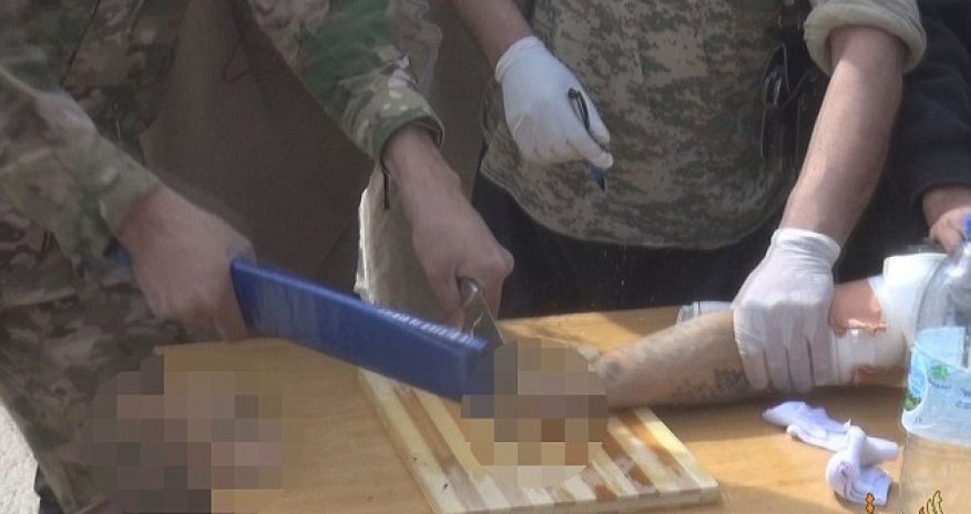 ISIS carry out shockingly crude amputation of 'motorbike thief'