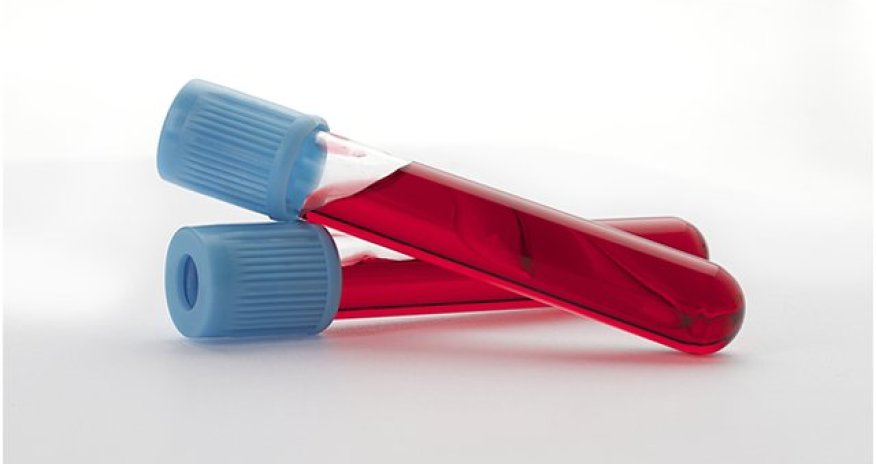 Rapid blood test to 'cut antibiotic use'