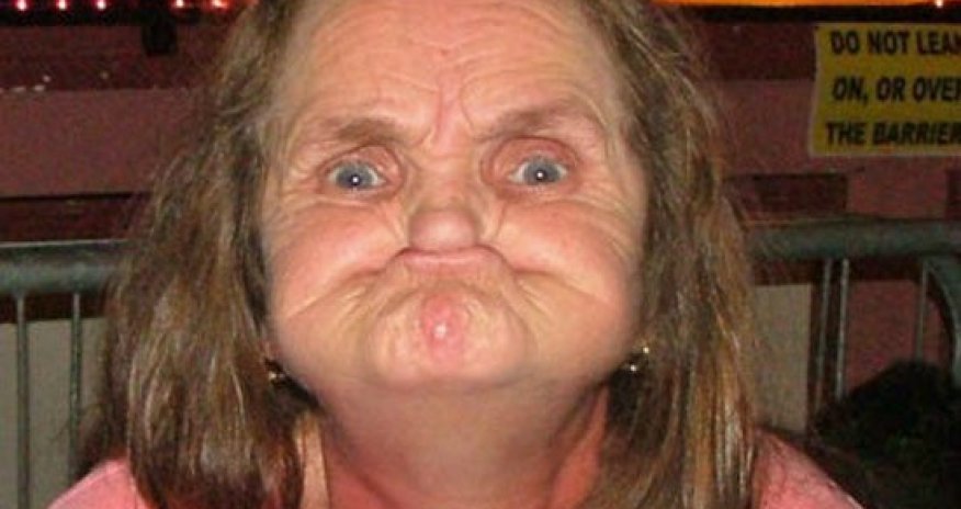 Dünyanın ən çirkin qadını öldü - Fotolar