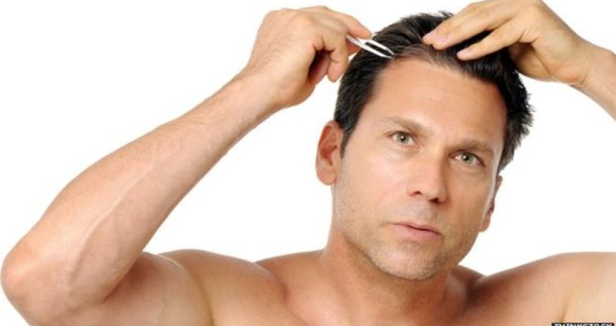 Plucking hairs 'can make more grow'