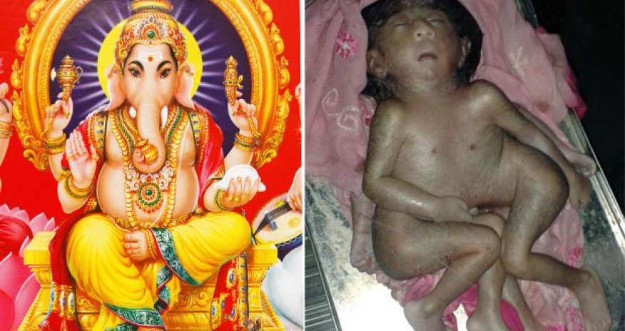 Baby born with EIGHT limbs worshipped as 'Hindu God'
