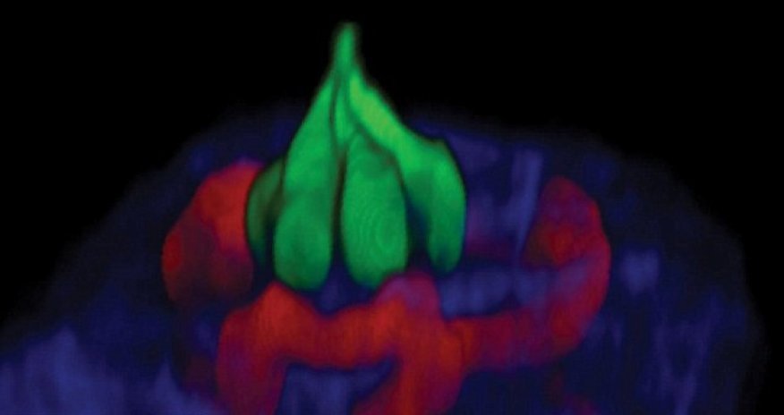 Lasers reveal what taste LOOKS like