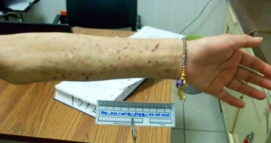 Woman slave who was tortured and chained by the neck