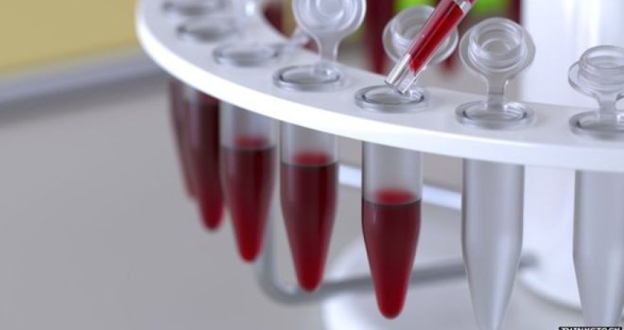 Blood test 'boost' in ovarian cancer fight